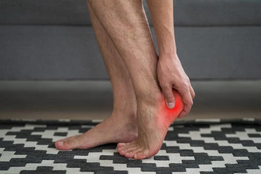 Plantar Fasciitis